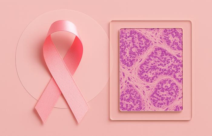 Sergio F Cara (NotiPress/Composición)