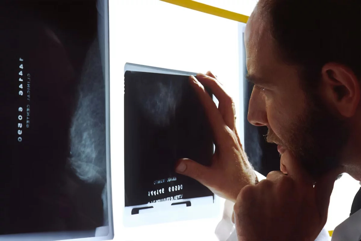 Cáncer de mama inflamatorio: señales en la piel sin un bulto palpable