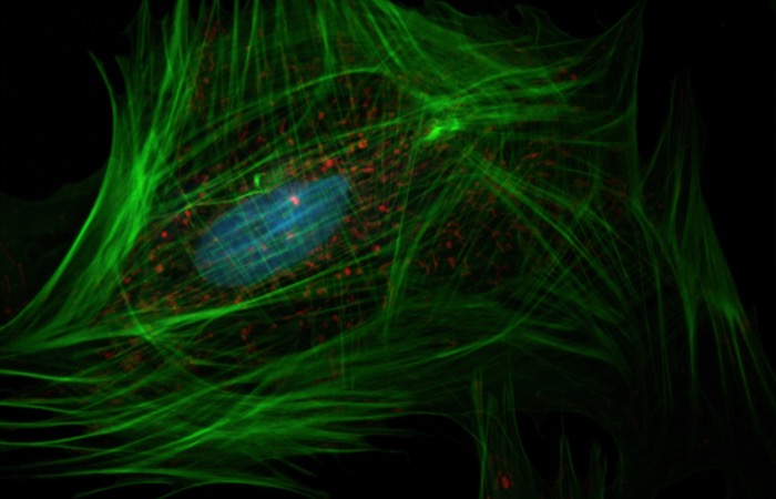 National Cancer Institute en Unsplash